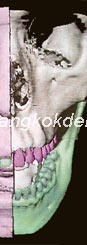 CT ~{I(Ch;{3]=CU}JuB|9H~}, CT ~{I(Ch;{3]=CU}JuL)9z~}