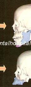 CT ~{I(Ch;{3]=CU}Ju~}, CT ~{I(Ch;{3]=CU}Ju~}